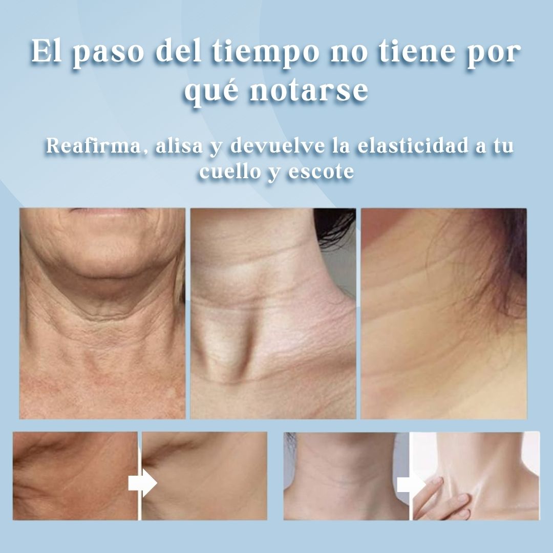 Elimina arrugas en solo 7 días con Skinlift