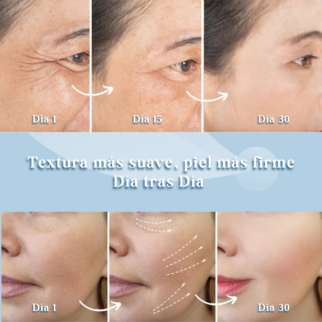 Elimina arrugas en solo 7 días con Skinlift